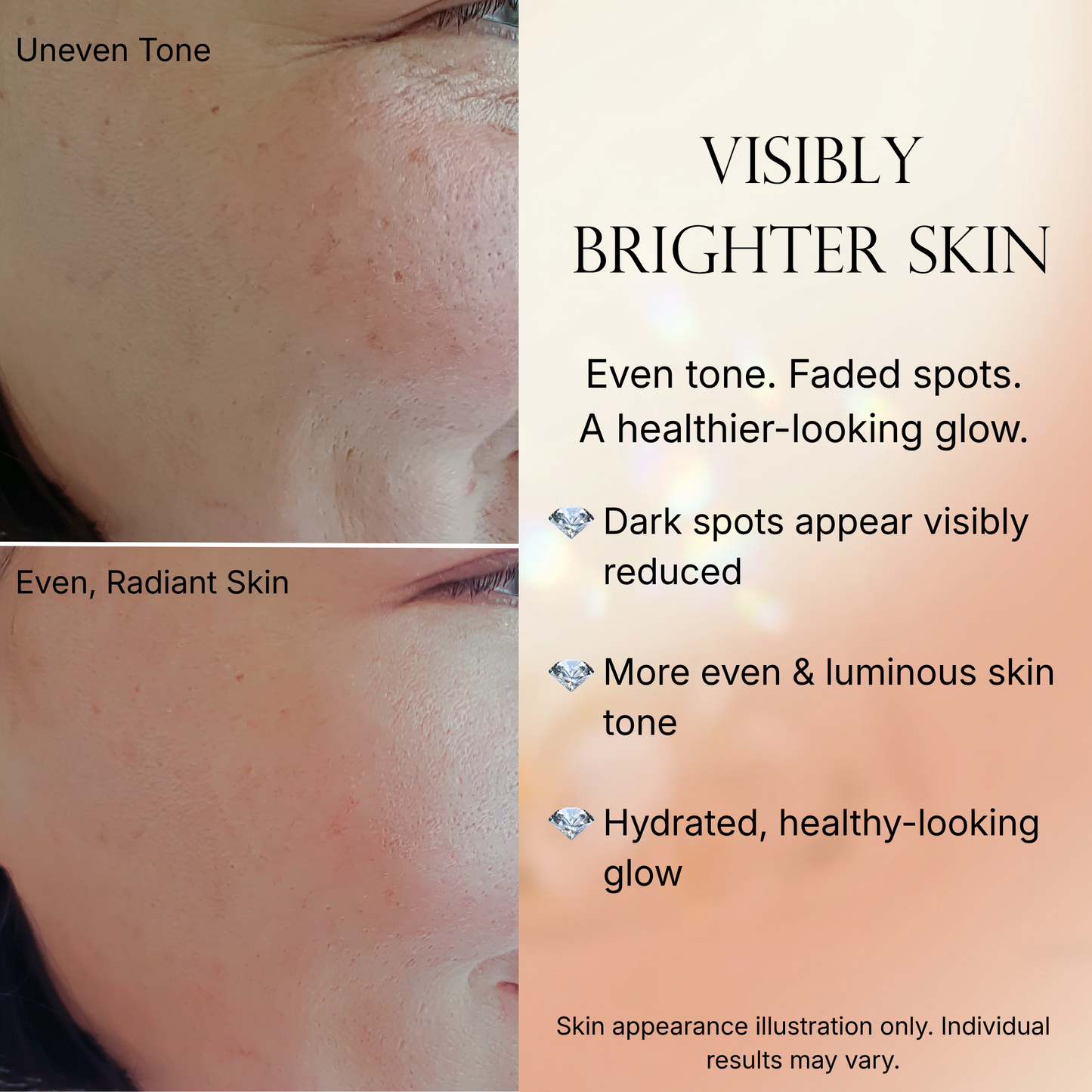 Caramela Beauty Even Tone Serum – Brightening Serum for Dark Spots & Hyperpigmentation with Kojic Acid, Hyaluronic Acid & Centella Asiatica – Radiant Healthy Glow – 1 fl oz / 30mL